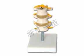 生物及醫(yī)療模型SM157 正常腰椎組合（三節(jié)）