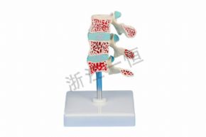 Biological and medical modelsSM-M008骨質(zhì)疏松模型